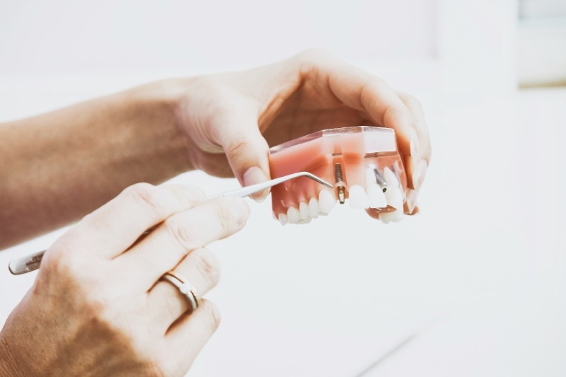 4 Things Dental Clinics In Cloverdale Take Care Of When Treating A Patient